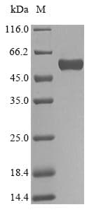 Human BGN / Biglycan Protein (Recombinant 10His-SUMO, N-terminus + Myc, C-terminus)