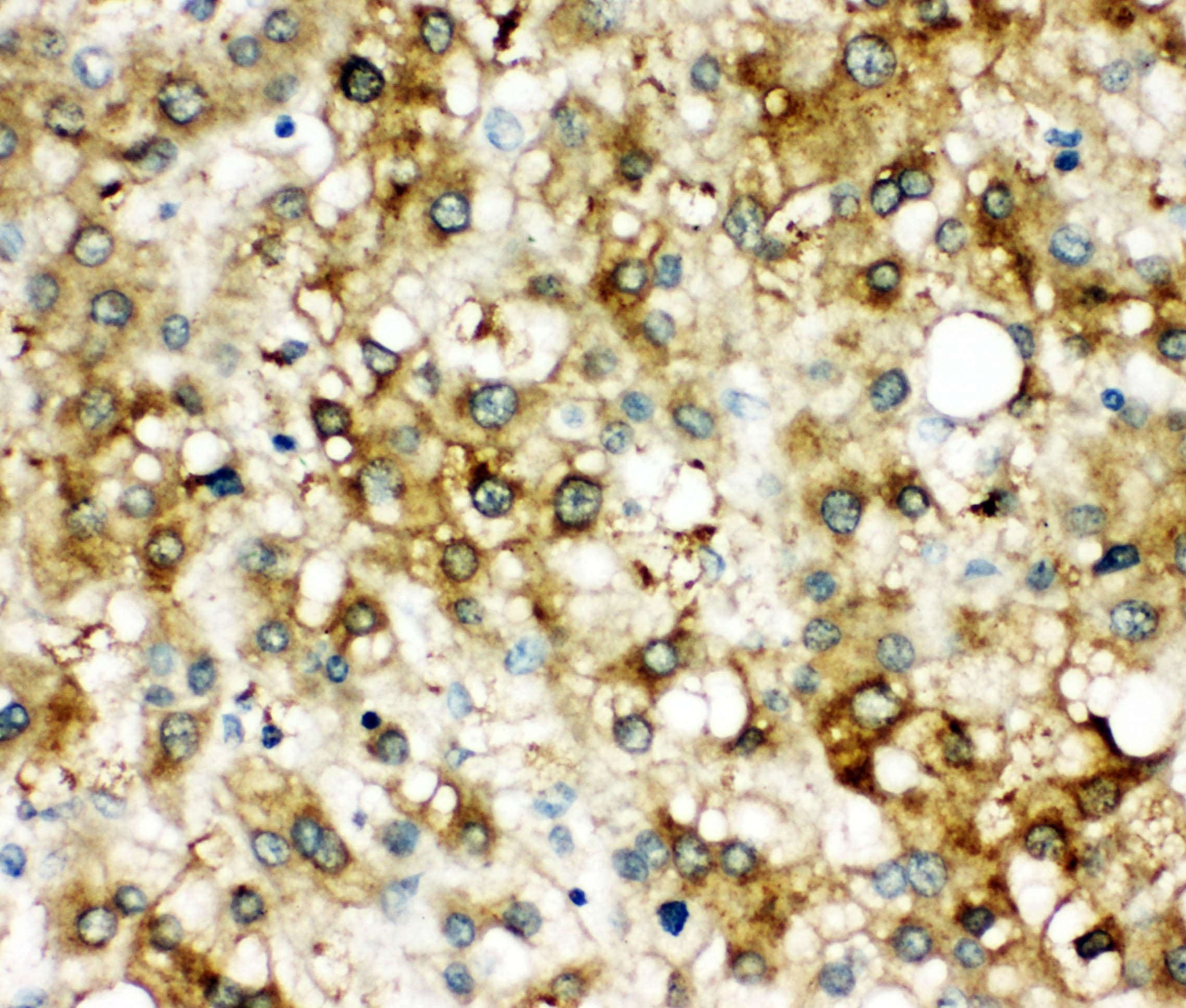 Alpha-1-Antichymotrypsin Antibody (aa218-232)