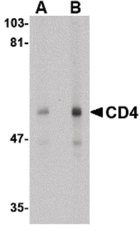 CD4 Antibody (clone 9H5A8)
