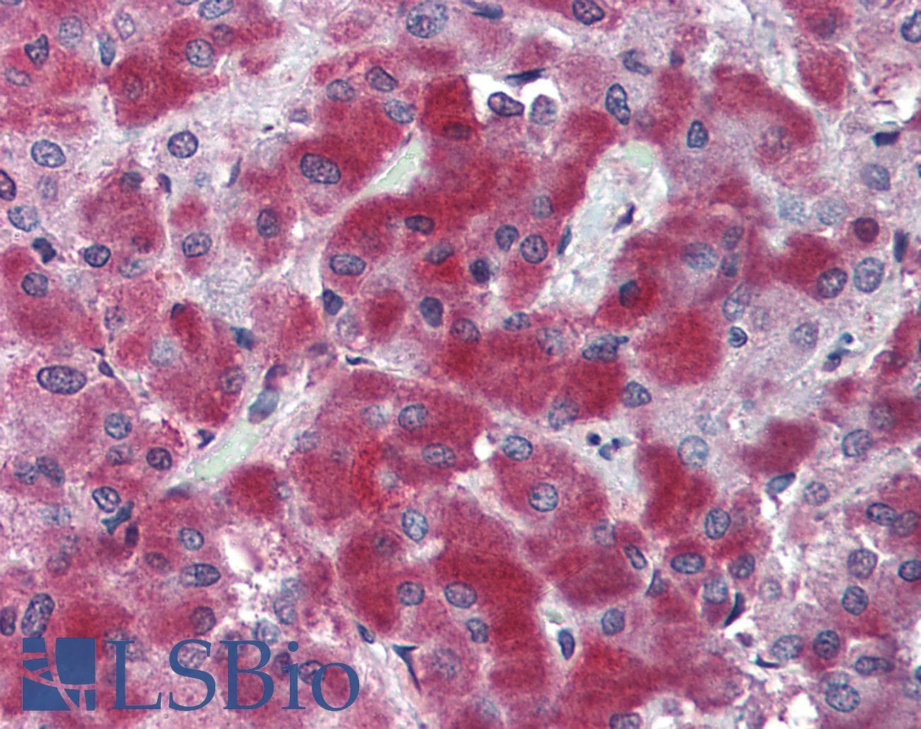 IHC-plus™ Polyclonal Rabbit anti-Human SUSD2 Antibody (Internal)
