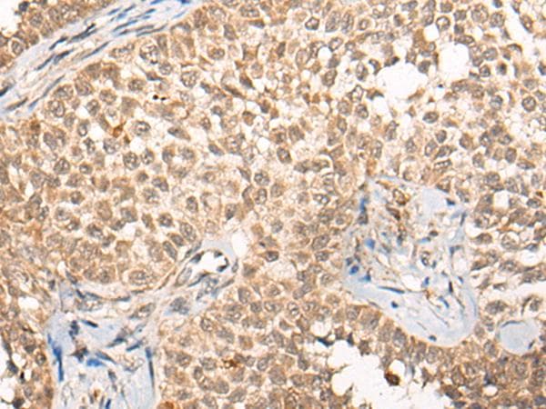 Polyclonal Rabbit anti-Human CABIN1 Antibody (IHC)