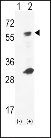 GCK / Glucokinase Antibody (aa403-433)