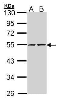IHC-plus™ TIP48 / RUVBL2 Antibody