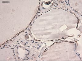 STAT3 Antibody (clone OTI21E7)