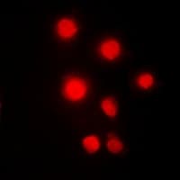 HMG2 / HMGB2 Antibody (Internal)