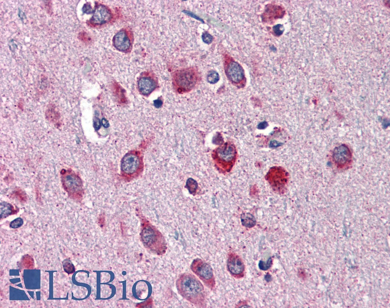 IHC-plus™ Neuroserpin Antibody (clone 1D10)