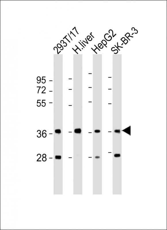 Polyclonal Rabbit anti-Human AKR7A3 Antibody (aa33-64, WB)
