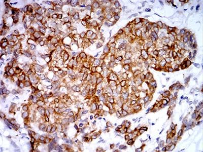 PGRMC1 / MPR Antibody (clone 6F9A1)