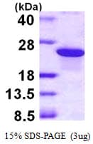 Human ARL8 / ARL5B Protein (Recombinant His)