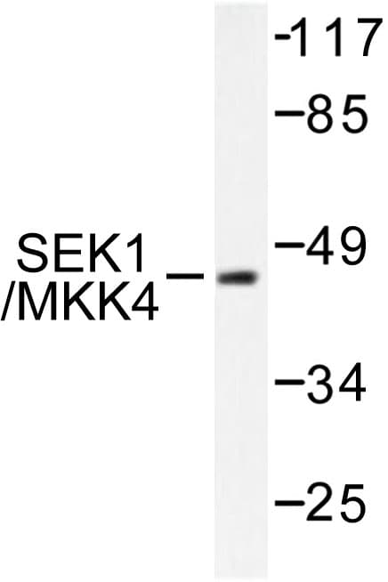 MAP2K4 / MKK4 Antibody (Glu74)