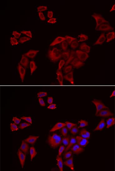 Polyclonal Rabbit anti-Human P2RX4 / P2X4 Antibody (IHC, IF, WB)