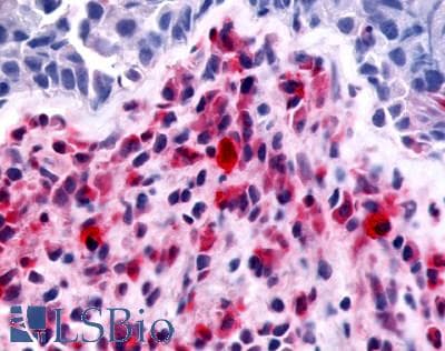 PathPlus™ MST1R / RON Antibody (C-Terminus)