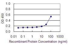 ITGAE / CD103 Antibody (clone 6B8)