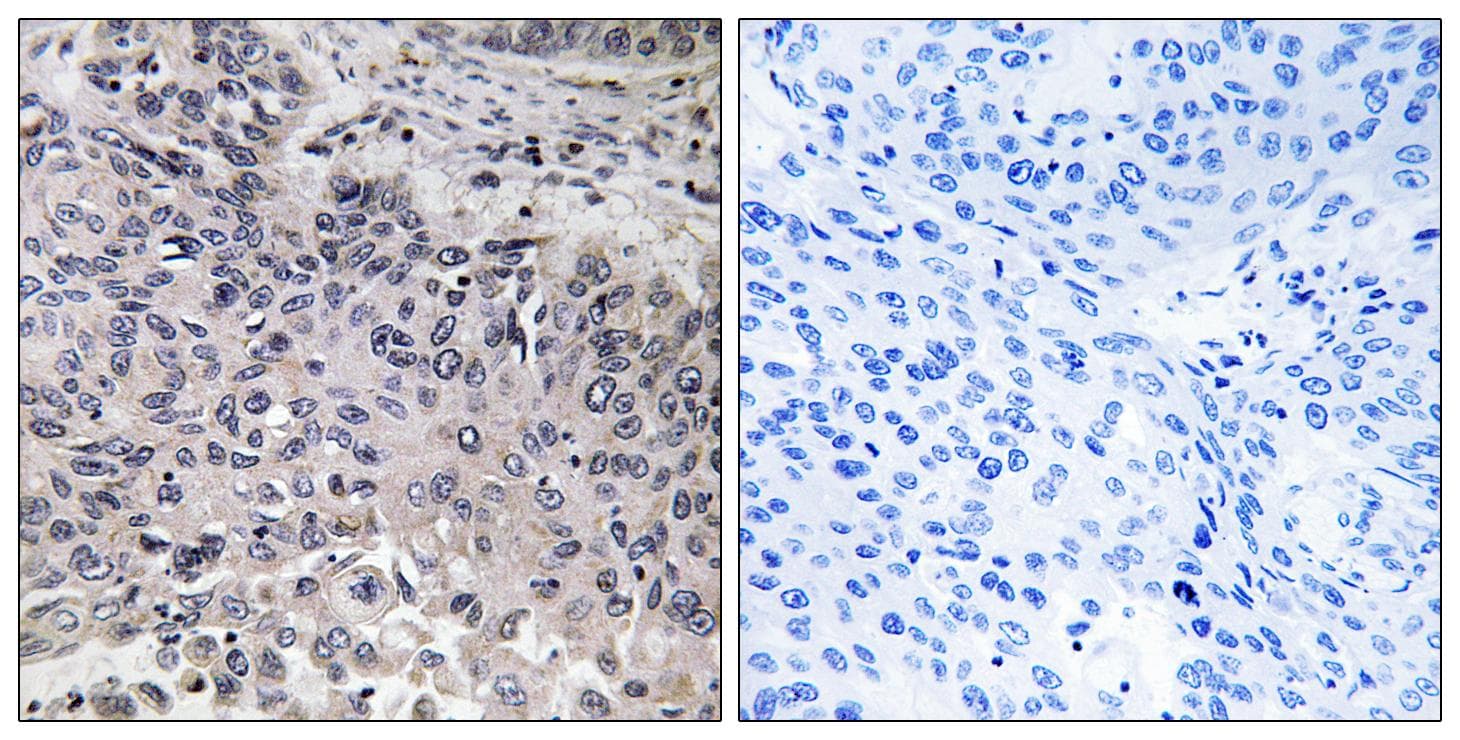 C1QG / Complement C1QC Antibody