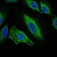 AURKA / Aurora-A Antibody (clone 1F8)