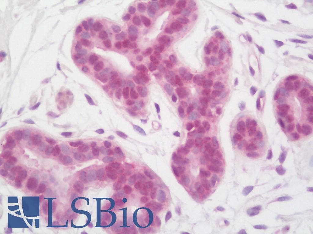 IHC-plus™ Polyclonal Rabbit anti-Human INO80 Antibody (aa1400-1450, IHC)