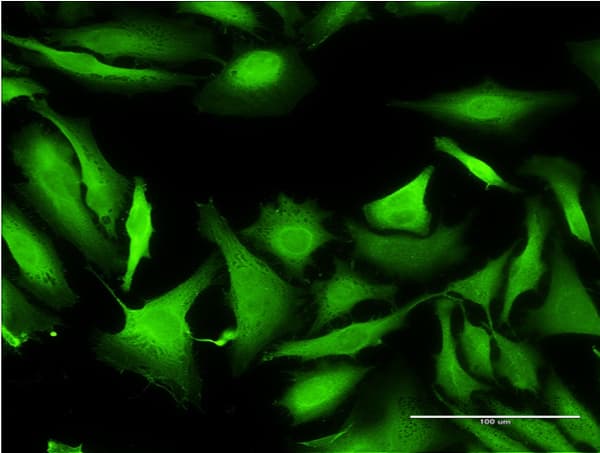 Monoclonal Mouse anti-Human SEPT1 / Septin 1 Antibody (clone 1F12, IF, WB)