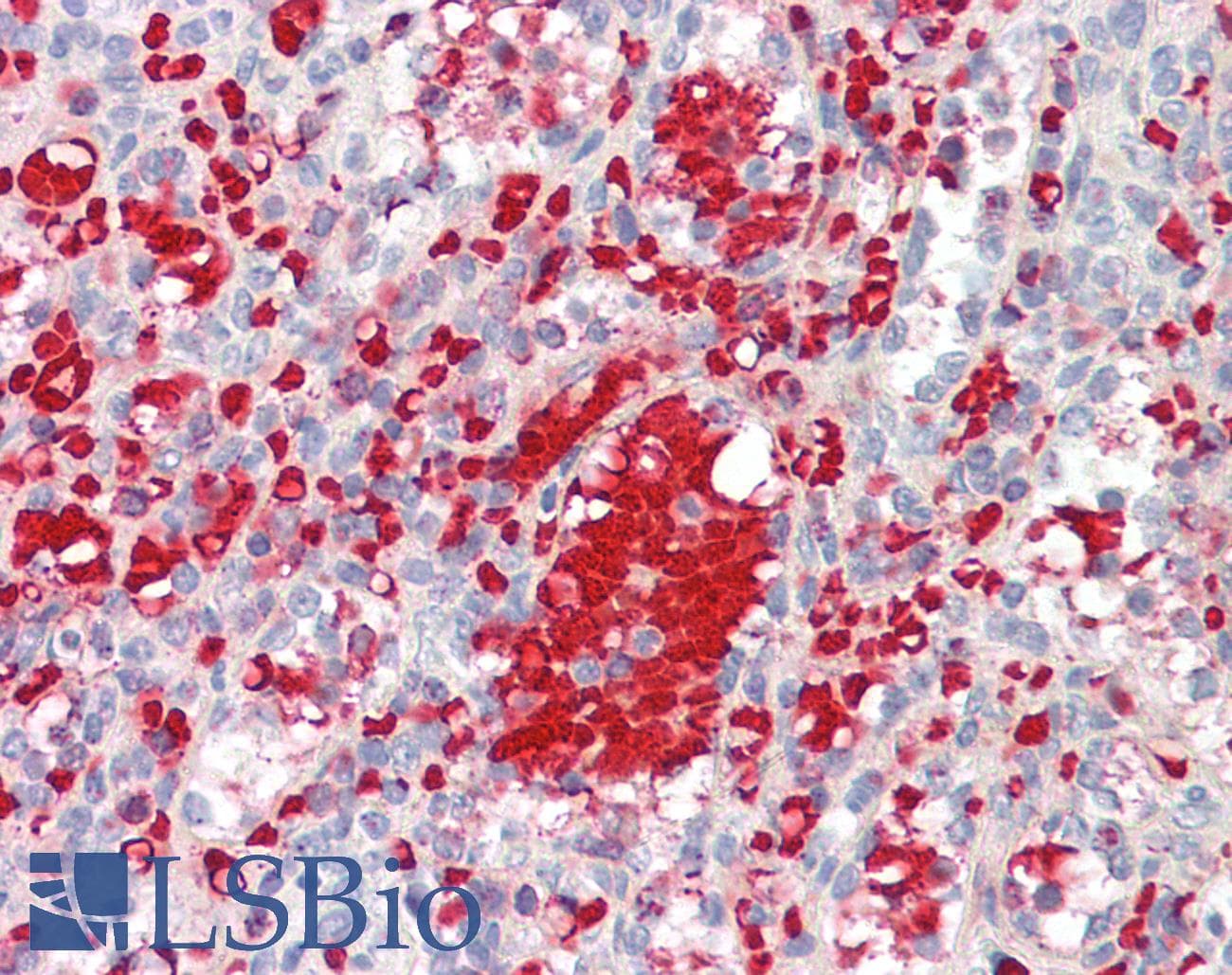 IHC-plus™ IGF1 Antibody (aa100-109)