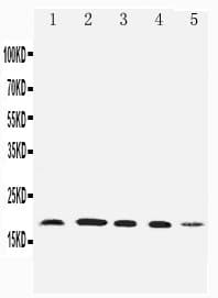 Polyclonal Rabbit anti-Human FAT10 / UBD Antibody (aa27-40, IHC, WB)