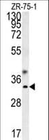 GTPCH1 / GCH1 Antibody (aa39-67)