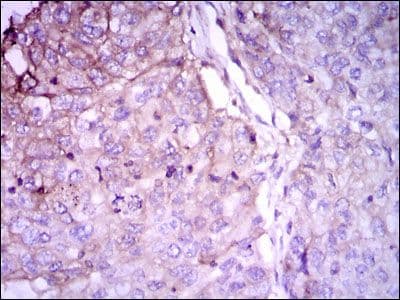 Monoclonal Mouse anti-Human RAB4A / RAB4 Antibody (clone 4E+11, IHC, WB)