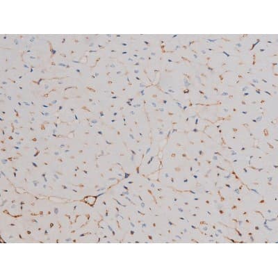 Polyclonal Rabbit anti-Human CDC25A Antibody (phospho-Ser124, IHC, IF, WB)