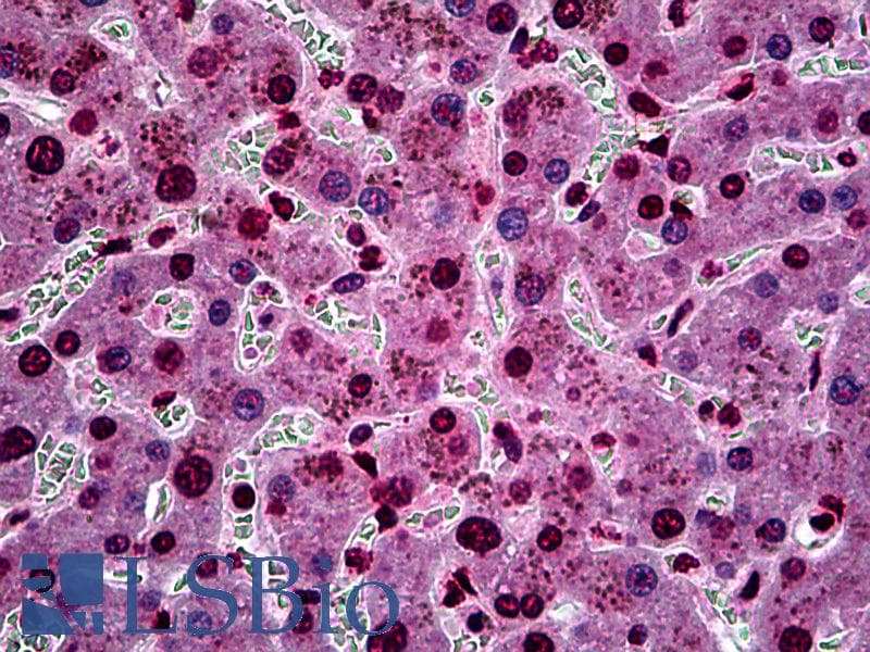 IHC-plus™ SGK1 / SGK Antibody (clone 3E3)
