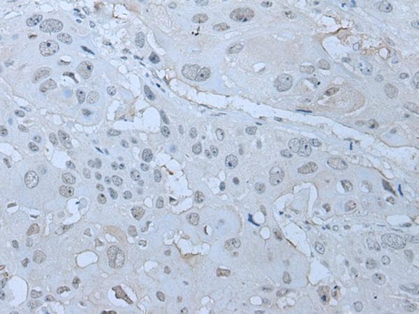 HUWE1 / ARFBP1 Antibody