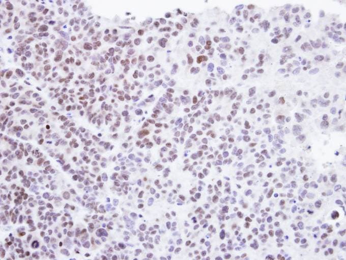 Polyclonal Rabbit anti-Human HMBOX1 Antibody (aa142-407, IHC, WB)