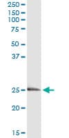 IHC-plus™ Monoclonal Mouse anti-Human Endothelin 3 / EDN3 Antibody (clone 2A6-2A4, IHC, WB)