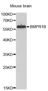 IHC-plus™ Polyclonal Rabbit anti-Human ALK-6 / BMPR1B Antibody (IHC, IF, WB)