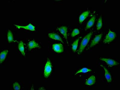 KLHL2 / MAV Antibody