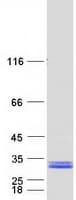 Human HSCB Protein (Recombinant Myc-DDK (Flag))