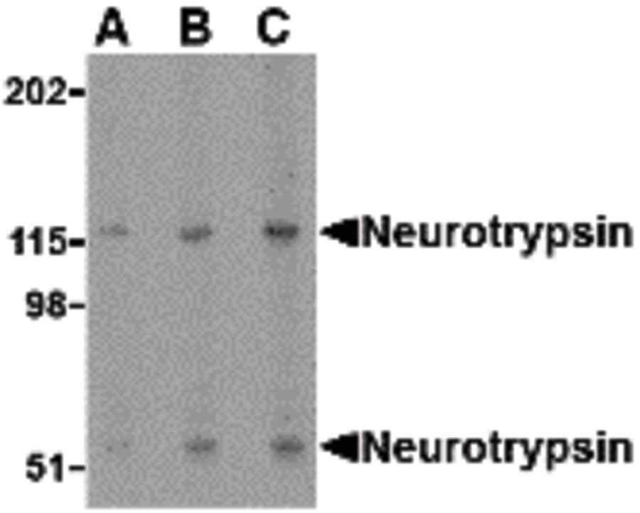 IHC-plus™ Polyclonal Rabbit anti-Human Neurotrypsin Antibody (IHC, IF, WB)