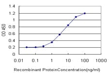GRK4 Antibody (clone 6D12)