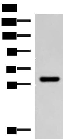 MYOT / Myotilin Antibody