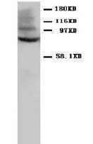 JUP/CTNNG/Junction Plakoglobin Antibody (N-Terminus)