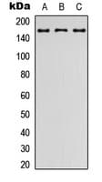 Polyclonal Rabbit anti-Human ADGRL2 / LPHN2 Antibody (aa556-595, IHC, WB)