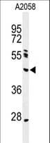 NEIL1 Antibody (aa130-159)