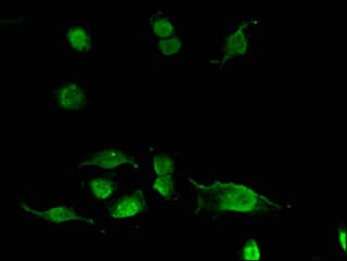 ACYP2 Antibody