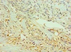 NTRK2 / TRKB Antibody (aa32-282)
