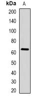 Polyclonal Rabbit anti-Human STAU1 / Staufen Antibody (IHC, WB)