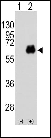MYC / c-Myc Antibody (Thr58)