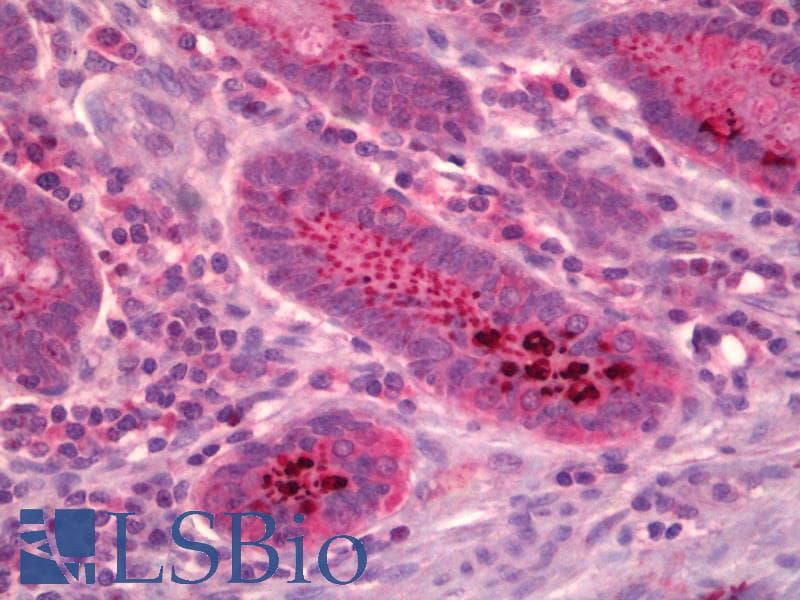 IHC-plus™ Protein Phosphatase 2 A/B Alph Antibody (N-Terminus)