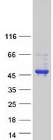 Human ALX / HSH2D Protein (Recombinant Myc-DDK (Flag))