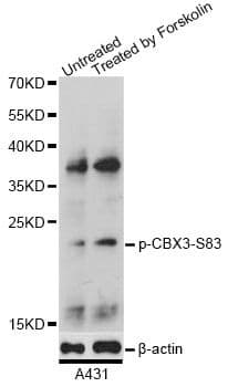 CBX3 / HP1 Gamma Antibody (phospho-Ser83)