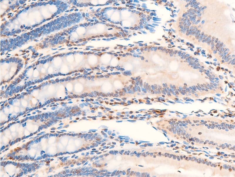 Polyclonal Rabbit anti-Human NTRK1 / TrkA Antibody (phospho-Tyr680,phospho-Tyr681, IHC, WB)