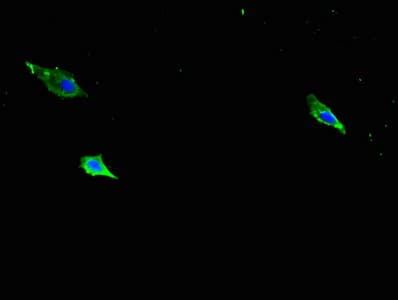 ITGB1 / Integrin Beta 1 / CD29 Antibody