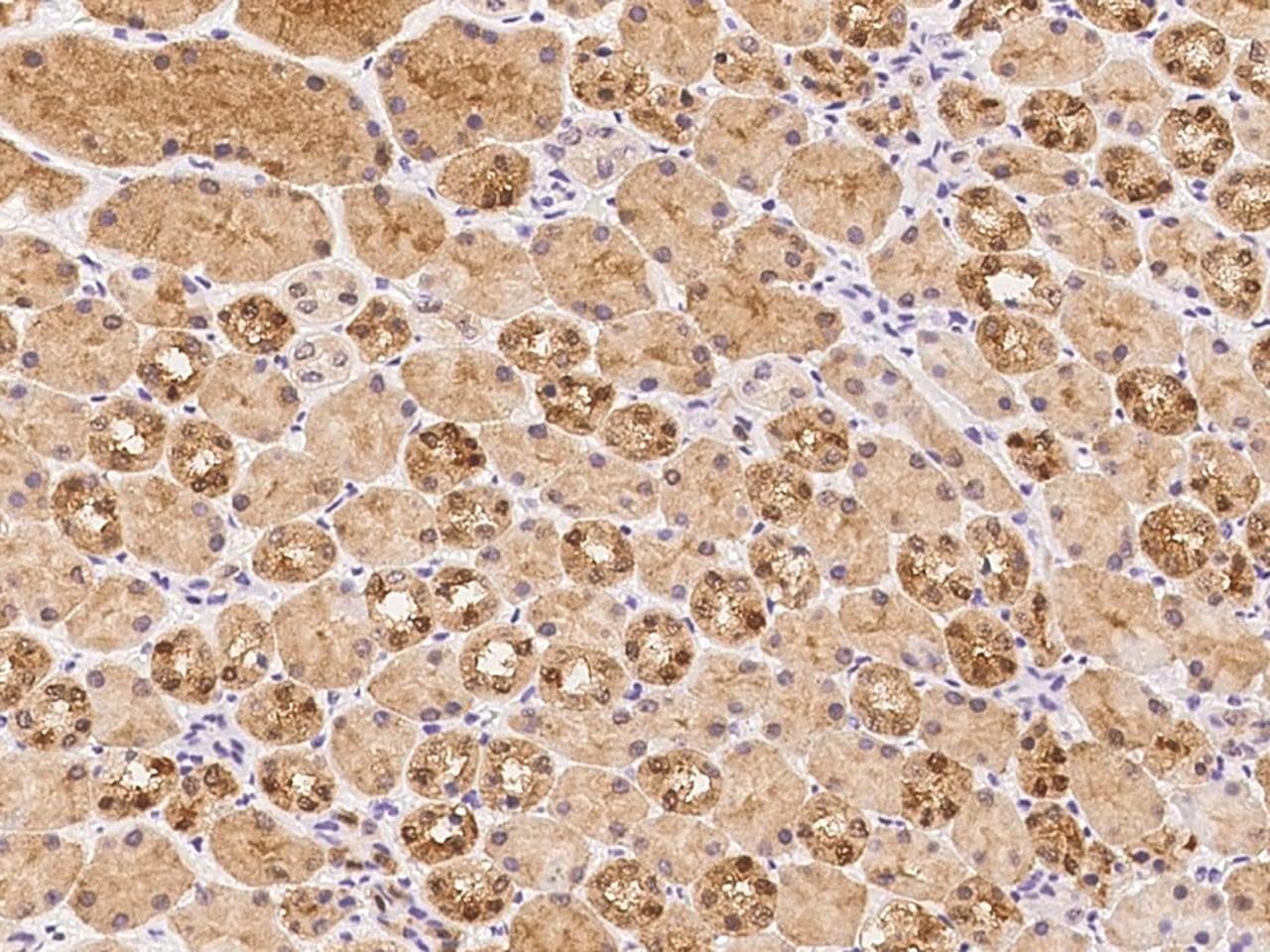 Polyclonal Rabbit anti-Human SULT1C2 / Sulfotransferase 1C2 Antibody (IHC)