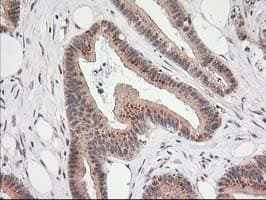 MGLL / Monoacylglycerol Lipase Antibody (clone OTI4D1)